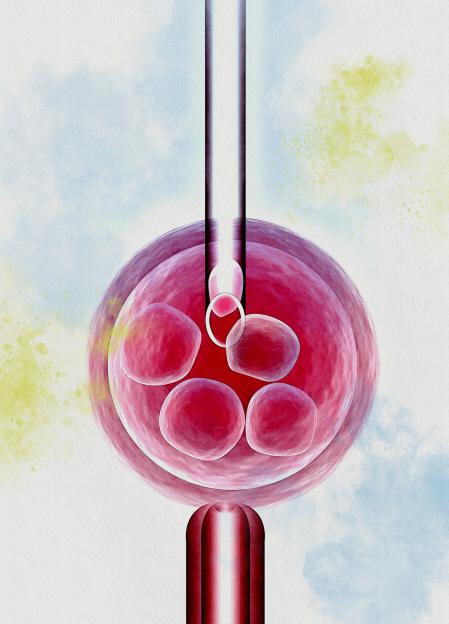 IVF, illustration