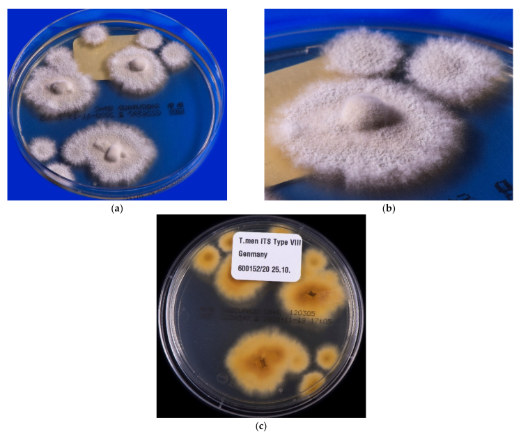 Collage of petri dishes showing Trichophyton indotineae.