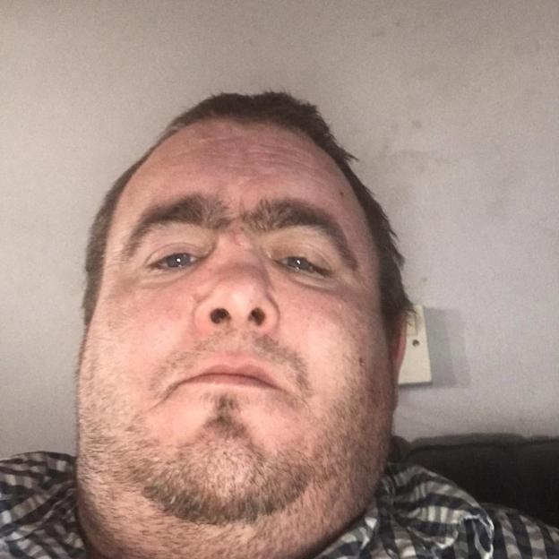 Stephen Ogilvie, victim of an attack in Belfast, appears with bruises and injuries on his face, looking directly into the camera.