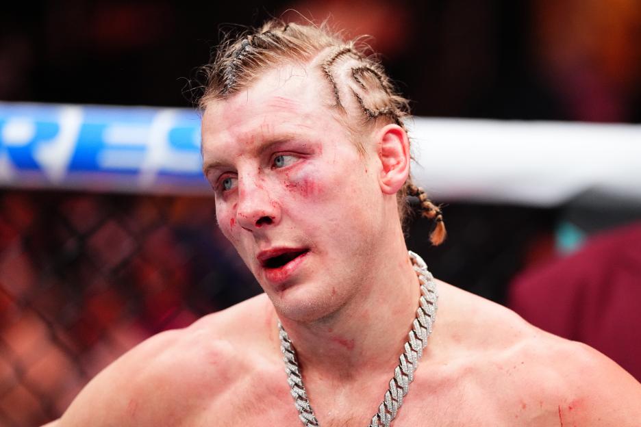 Paddy Pimblett with a bruised and bloodied face after a UFC lightweight interim championship bout.