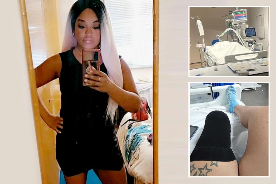 'I Faced Every Parent's Nightmare: Stranded on a Train Crossing, I Was Hit by a Train and Electrocuted, Resulting in a Leg Amputation'