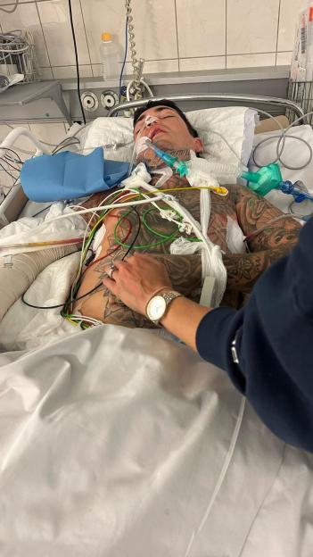 A man with tattoos on his chest and arms is in a hospital bed, surrounded by medical tubes and wires, with a hand resting on his stomach.