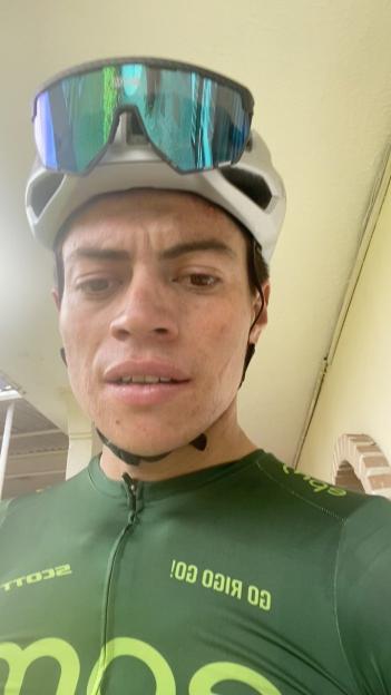 Tragic Loss: 30-Year-Old Cycling Star Passes Away After Horrific Knee Injury from Crash, Heartfelt Tributes Pour In