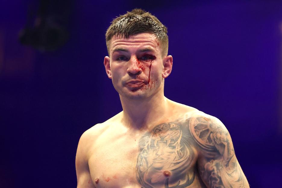 Sam Noakes with a cut over his right eye.