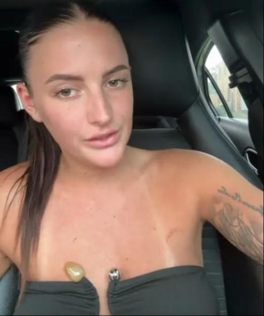 “I’ll Never Wear a Claw Clip While Driving Again – It Shattered During a Crash and Left Me in a Neck Brace”