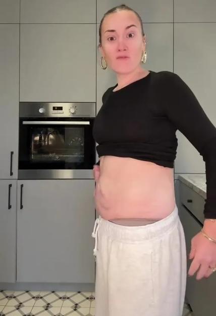 Woman showing loose skin on her abdomen after weight loss.