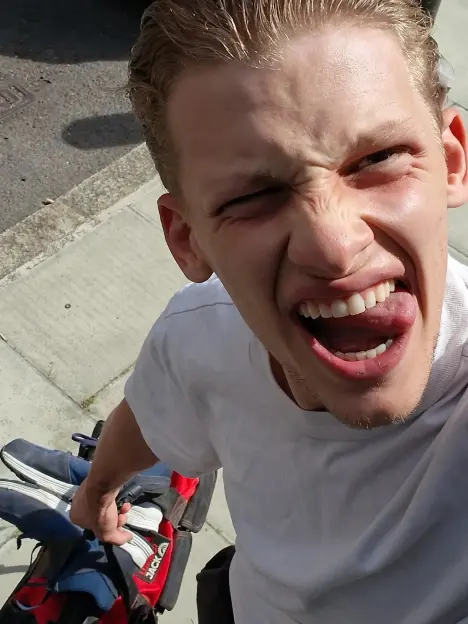 Freddy Brazier Opens Up About Taking a Manual Labor Job After Scary Hospital Visit from Pocket Bully Attack