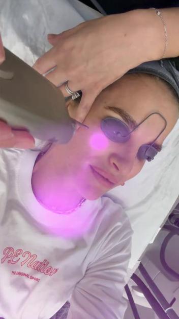 Vogue Williams from I’m a Celeb Shares Her 'Intense' Cosmetic Treatments and Weight Loss Journey