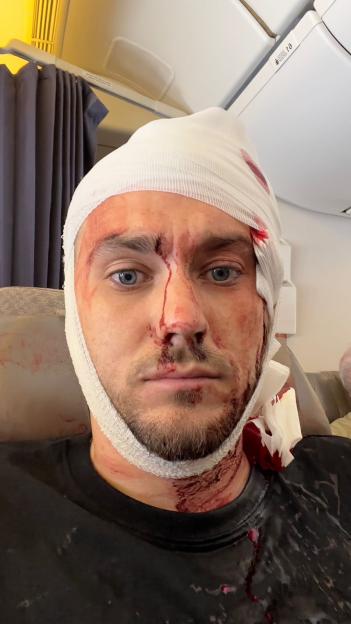 Man on board Singapore Airlines left with severe injuries and unable to work