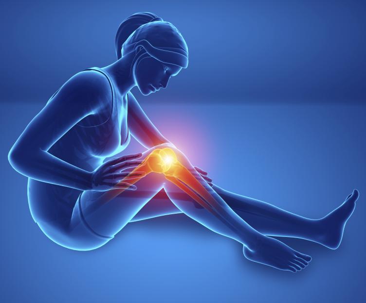 Illustration of a woman experiencing knee pain.