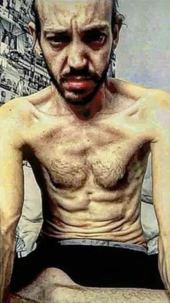 Collage of a man's physical transformation from emaciated to healthy.